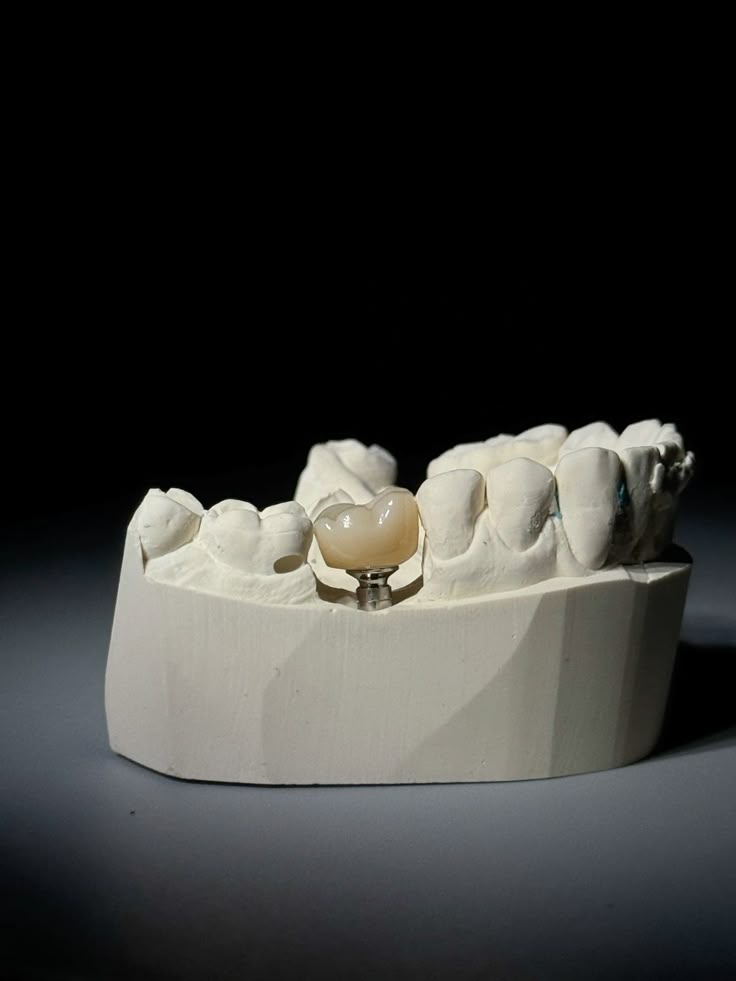 Dental crown and implant restoration model