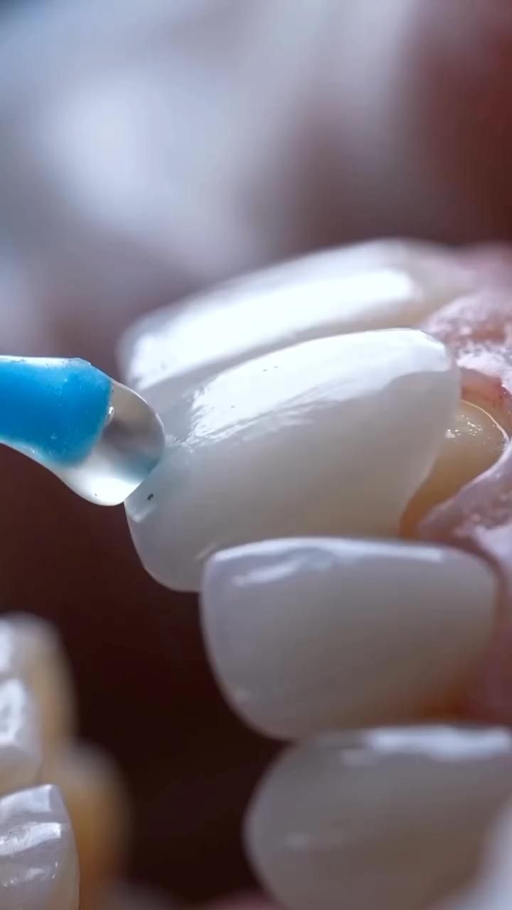 Professional dental cleaning and preventive care tools